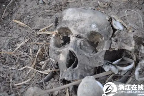 余杭惊现白骨吓坏村民原来是实验里的石膏标本