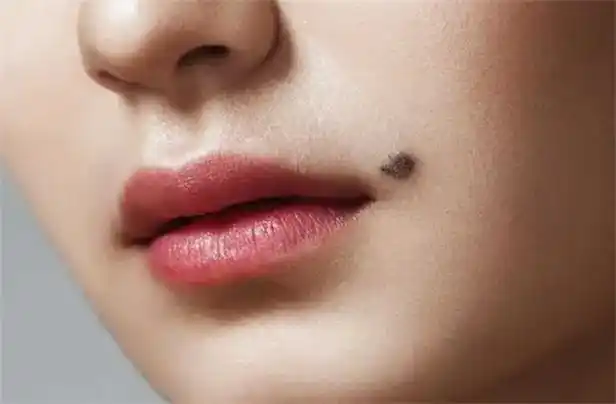 哪里长痣的女人最命好