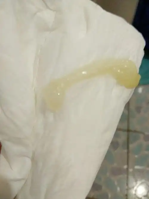 请问宝妈们会不会出现这样的白带