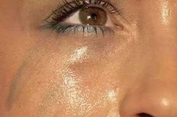 夏天皮肤出油多长痘痘毛孔粗大怎么办?3个控油小妙招分享