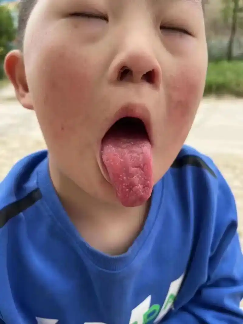 看到这个孩子的舌头 你想到了什么? 我想到了因为原生家庭关系不好