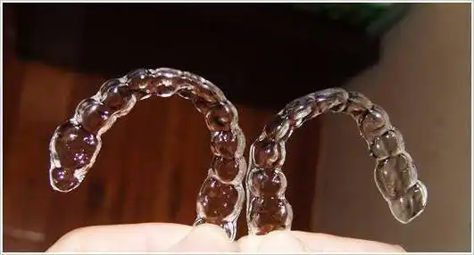 牙齿矫正正畸须知:远离19大护理弊端坏处_口腔_问题_牙龈