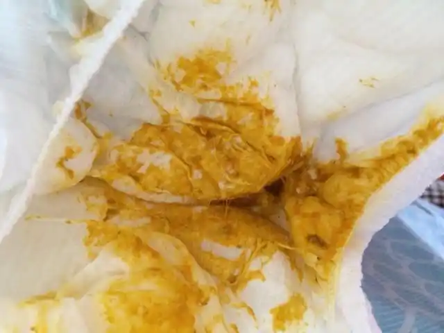 【有图慎入】宝宝全母乳 今天大便这样是不是着凉了