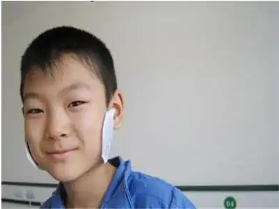 小学生怎样避免腮腺炎复发