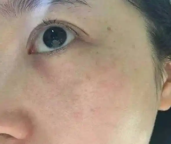 怎么调理脸色发黄暗沉脸色发黄发暗怎么调理