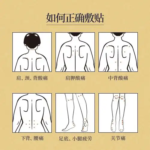 日本进口nichiban温感止痛穴位膏药贴156片新低448元包邮包税需领券