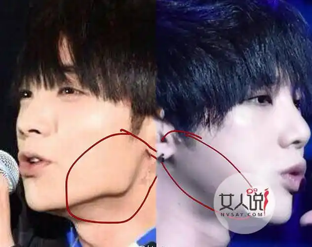 华晨宇整容前后对比照包子脸的杀马特屌丝成功逆袭成男神