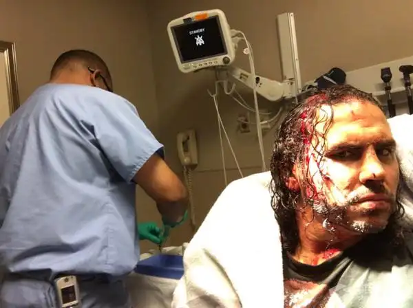 马特·哈迪被爆头,血流满面!-搜狐