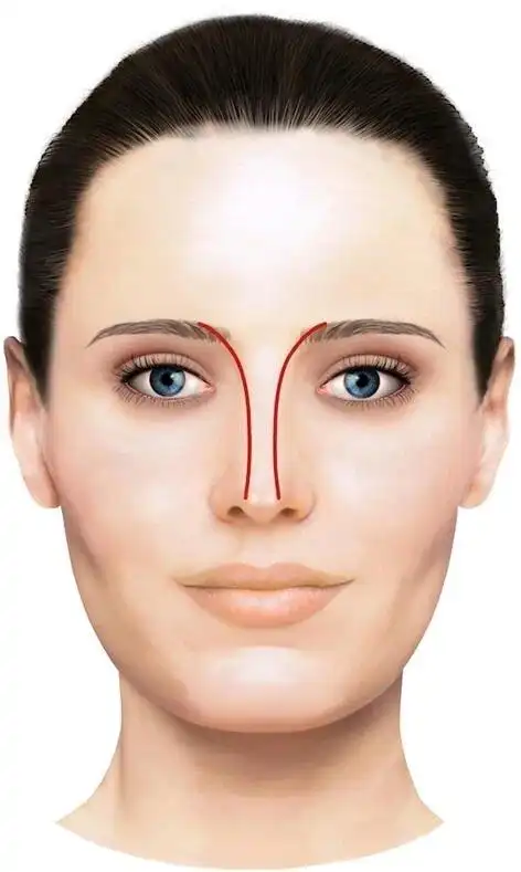 注射改善鼻尖下垂