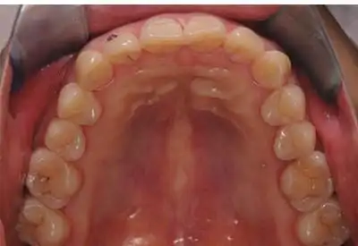 口腔美学临床影像规范介绍和解读