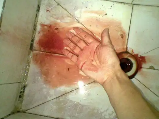 手指流血图片52