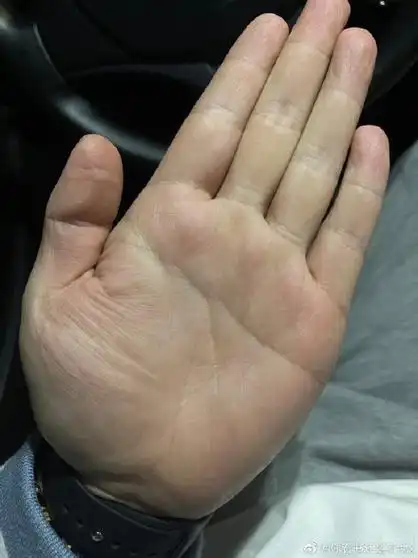 从缘主的手相上看,缘主无名指稍长,智慧线假断掌,属于有艺术天赋的,对