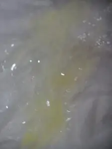 这颜色的痰注意