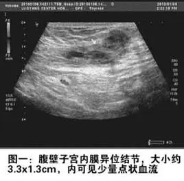 腹壁子宫内膜异位症