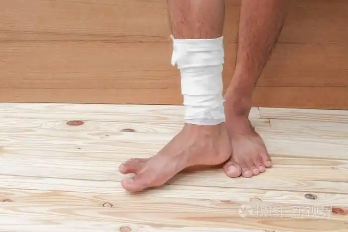 纱布绷带的医师脚踝受伤的治疗情况