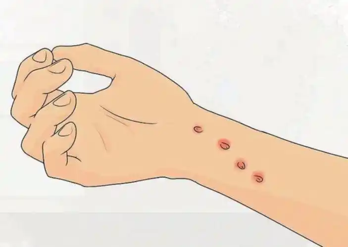 想要避免感染猫抓病这些事情平时就要做好01 定期为猫驱虫跳蚤,虱子等