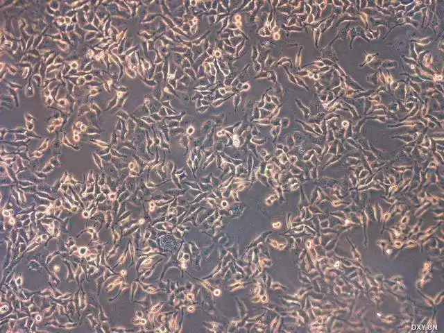 【求助】这个hela细胞的形态对吗?请教高手