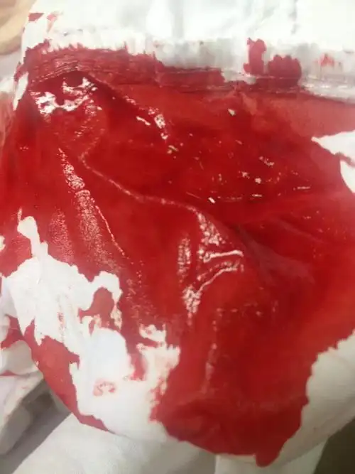 谁有手有血的图片要现实中的不要网络的