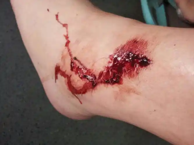 雨林生态面面观