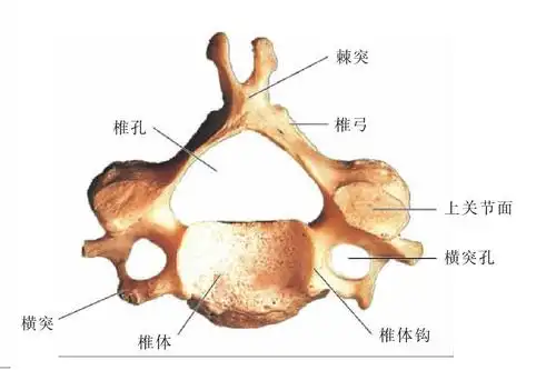 图6 颈椎(上面观)-人体解剖组织学-医学