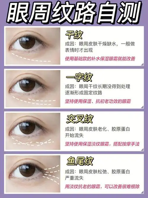 眼纹自查10s掌握淡纹方法
