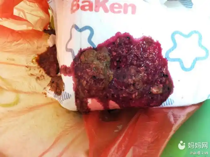 我家宝贝吃了几天火龙果,拉的大便怎么也是这种,是不_妈妈网孕育社区