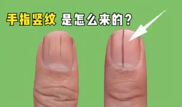 指甲竖纹多有白点是什么原因(指甲上的月牙白点)(1)