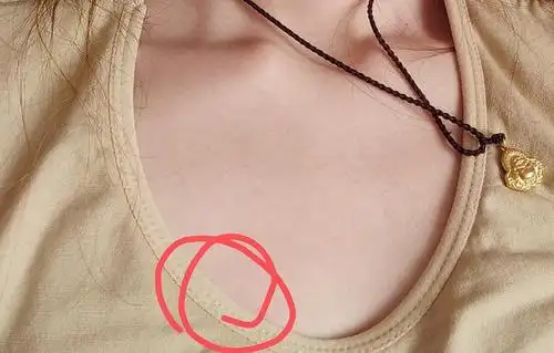 为什么乳头突然特别疼