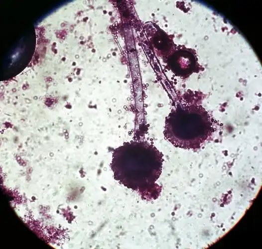 > 平时食物发霉是件很令人头疼的事,可是霉菌在显微镜下的照片却兔览