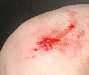 公安民警蓄意伤人,草菅人命,百姓有冤无处申