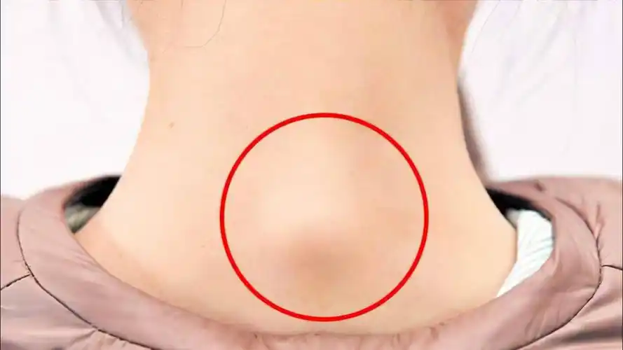 富贵包夺命包这三个动作帮您缓解颈椎问题