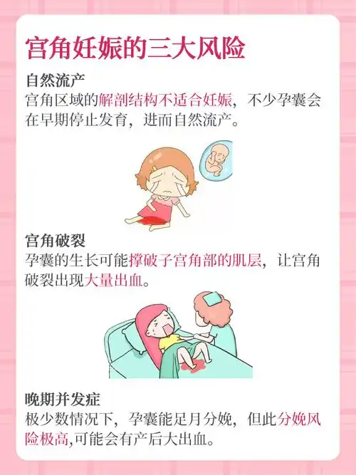 宫角妊娠:解读这一"特殊"的妊娠现象