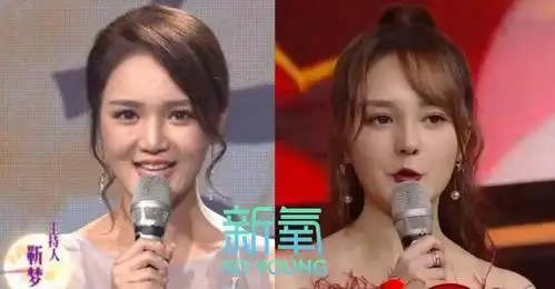 她是第一个靠鼻基底假体登上热搜的女主持!