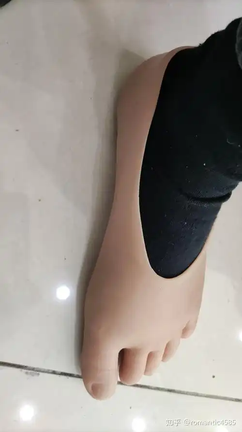 半足截肢患者选择假肢标准介绍(知乎版) - 知乎