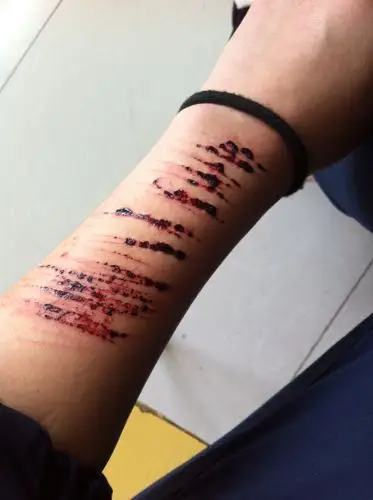 自己自残了怎么办