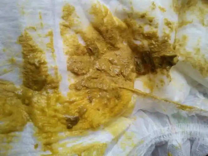 这大便是什么颜色