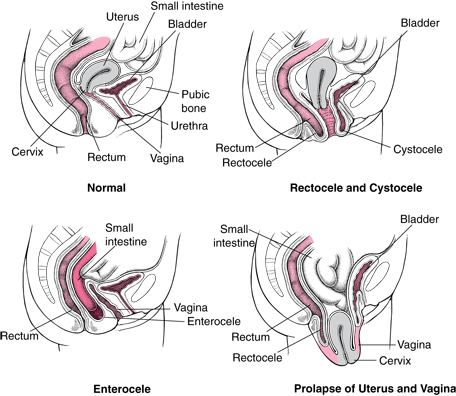 female vaginal muscles picture