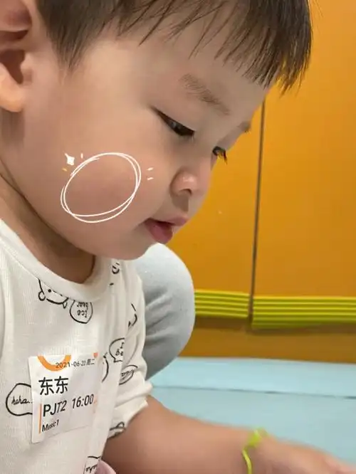 实用贴-宝宝脸上的小米粒