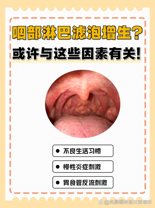 喉咙干痒,异物感反复发作,照镜子发现咽后壁有小颗粒凸起?