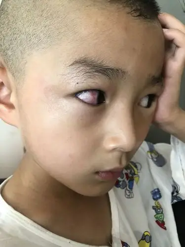 这孩子的眼睛怎么啦,各位帮忙看下