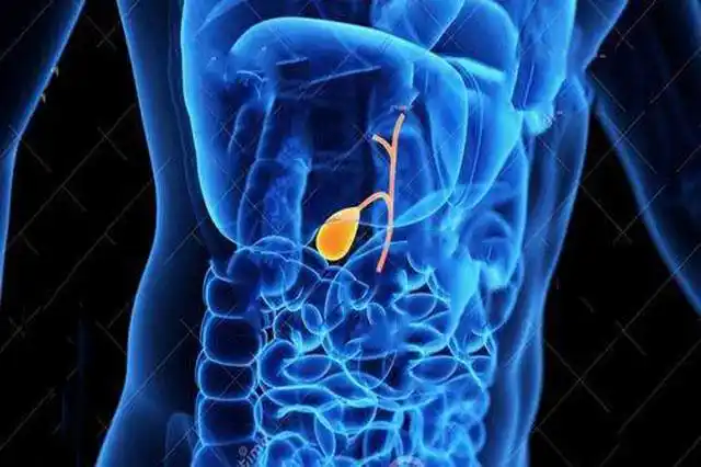 胆囊"罢工"后,食物将何去何从?