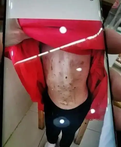 孩子的身上都是被烟头烫过的痕迹,一个个黑色的窟窿清晰可见.