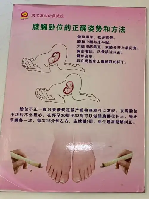 孕晚期产检胎位不正,开始膝胸卧位 熏艾,哭