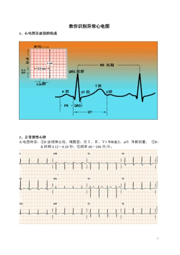 教你识别异常心电图.doc 9页