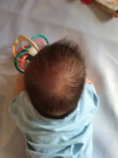 我家哥哥的偏头是不是很严重了