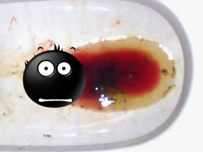 拉屎拉出大量的血怎么办啊(有图,慎入)