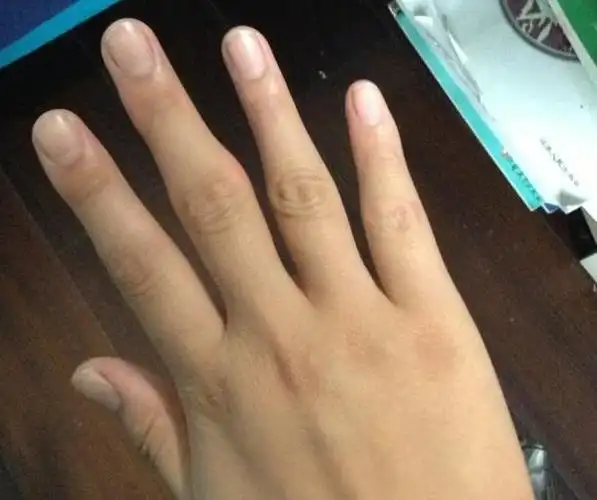 经常有一种说法是:手指关节粗的人生活劳碌,艰辛,关节细的人,生活安逸