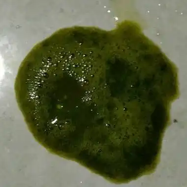 宝宝拉的粑粑都是绿色的怎麼办?还有沫沫?