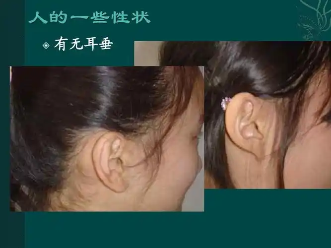 有无耳垂