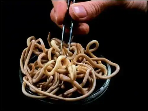 宝宝肚子里有蛔虫有什么表现宝宝肚子里有蛔虫有什么症状表现